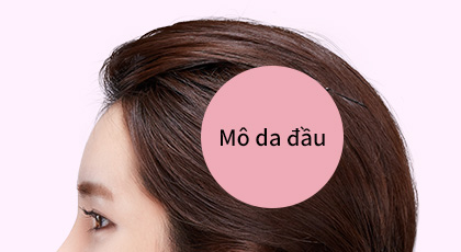 Mô da đầu