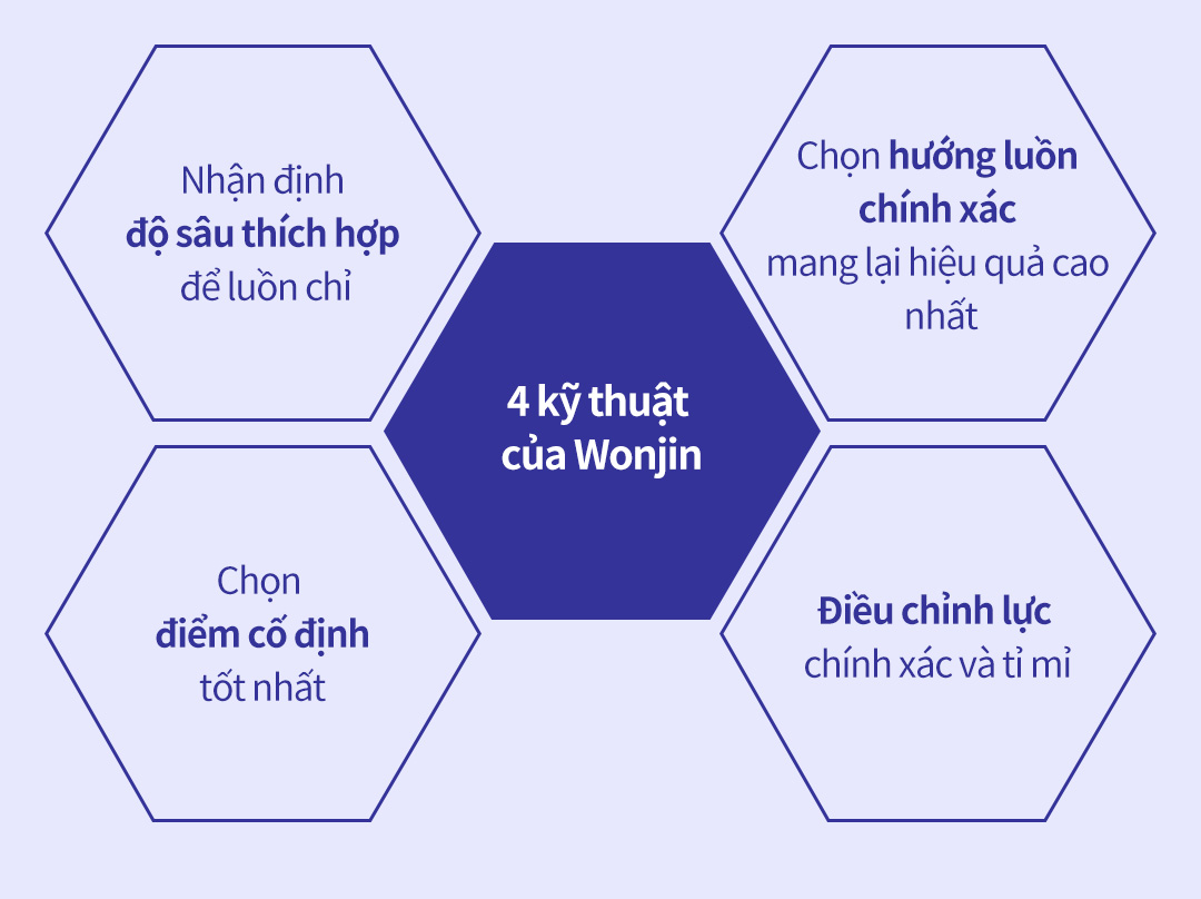 4 kỹ thuật -Nhận định độ sâu thích hợp để luồn chỉ , Chọn điểm cố địnhtốt nhất , Chọn hướng luồn chính xác mang lại hiệu quả cao nhất , Điều chỉnh lực chính xác và tỉ mỉ