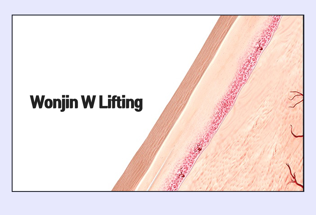 Wonjin W Lifting